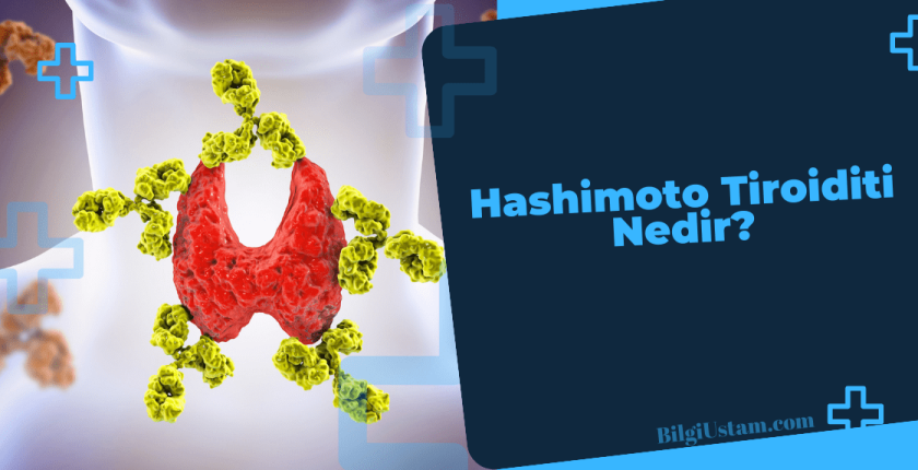Hashimoto Tiroiditi: Belirtileri, Tedavisi ve Yönetimi