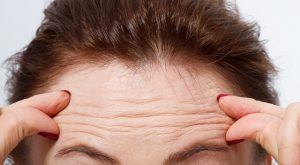 Kırışıklıklar Neden Olur?