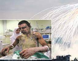 Beyaz Fosfor ve Fosfor Bombası Nedir, Beyaz fosfor Kimyasal Bir Silah Mıdır?