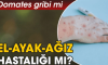 Domates Gribi Yeni Bir Hastalık Mı? Belirtileri, Nedenleri, Tedavisi ve Önlemler