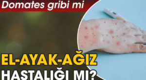 Domates Gribi Yeni Bir Hastalık Mı? Belirtileri, Nedenleri, Tedavisi ve Önlemler