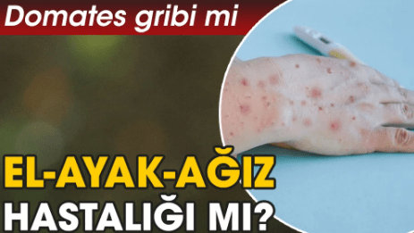 Domates Gribi Yeni Bir Hastalık Mı? Belirtileri, Nedenleri, Tedavisi ve Önlemler
