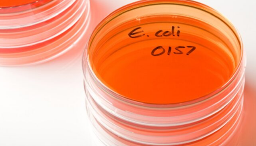 Shiga Toksini Üreten Escherichia coli (STEC) Enfeksiyonu, Bulaşma Yolları, Belirtileri ve Tedavisi