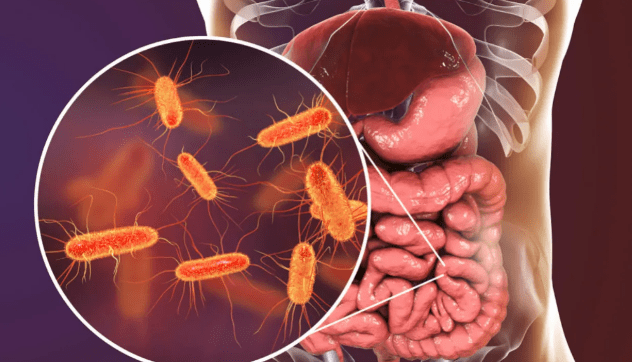 Shiga Toksini Üreten Escherichia coli (STEC) Enfeksiyonu, Bulaşma Yolları, Belirtileri ve Tedavisi