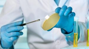 Karboksilik Asitler Nedir?