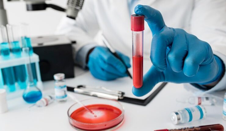 Kan Yağ Değerleri Bozukluğu (Lipid Metabolizma Bozukluğu) Nedir?