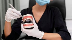Overbite Nedir? Overbite Tedavisi Nasıl Olur?