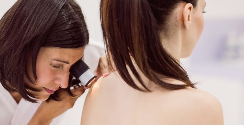 Papillomatöz Lezyon Nedir? Papillomatöz Lezyon Belirtileri