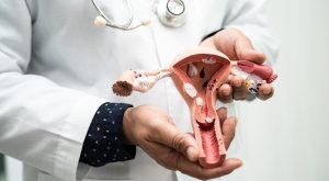 Ooferektomi (Yumurtalıkların Alınması) Nedir​? | Yumurtalık Çıkarma