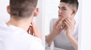 Kistik Sivilce Nedir?