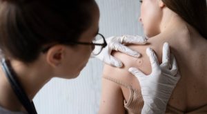 Punch Eksizyon Nedir? Punch Eksizyon Tedavisi