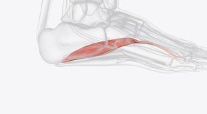 Ayak Kas İltihabı Nedir? Ayak Kas İltihabı Belirtileri