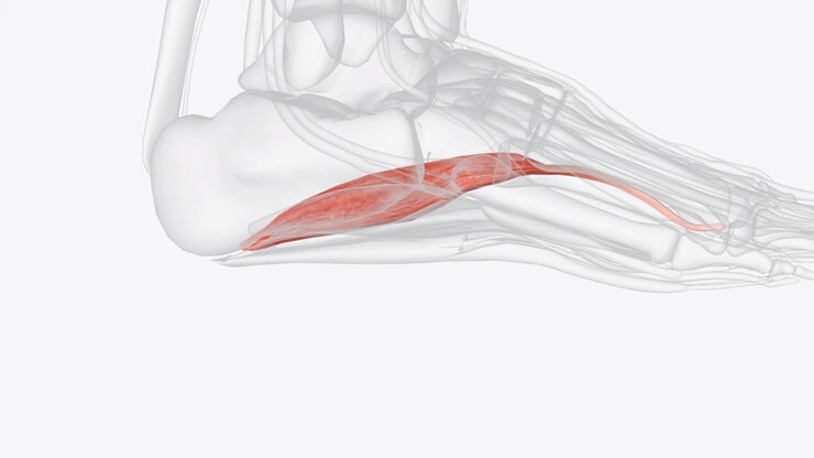 Ayak Kas İltihabı Nedir? Ayak Kas İltihabı Belirtileri