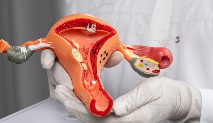 Trakelektomi (Trachelectomy) Nedir?